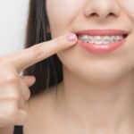 OrthoWax-Orthodontic-Wax-Mint-(CareDent),